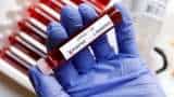 Coronavirus Lockdown: Major relief announced for these firms 