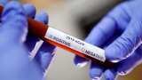 Hydroxychloroquine: Pharma firms increase 'HCQ' production to meet demand Hydroxychloroquine: Pharma firms increase 'HCQ' production to meet demand