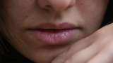 Most COVID-19 patients may lose sense of smell by third day of infection: Study Most COVID-19 patients may lose sense of smell by third day of infection: Study