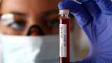 No COVID-19 vaccine? By no means guaranteed, says British PM Boris Johnson No COVID-19 vaccine? By no means guaranteed, says British PM Boris Johnson