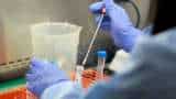 Better than remedesvir and dexamethasone? Novel Covid-19 treatment found by Indian-origin scientists Better than remedesvir and dexamethasone? Novel Covid-19 treatment found by Indian-origin scientists