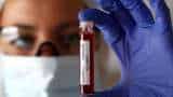 Covid-19 in India: Record 90,632 coronavirus cases in one day! Check state-wise data Covid-19 in India: Record 90,632 coronavirus cases in one day! Check state-wise data