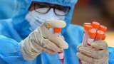 What is Feluda Test? How does it work? All you need to know about Tata CRISPRCOVID-19 test What is Feluda Test? How does it work? All you need to know about Tata CRISPRCOVID-19 test