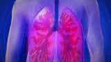 Early signs of Covid 19: Your lungs show these symptoms as a warning - check now Early signs of Covid 19: Your lungs show these symptoms as a warning - check now