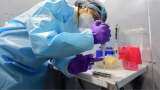 COVID-19 Delta Plus Variant in India: REVEALED! Why it is a MATTER OF CONCERN - Know what Union Health Secretary ADVISED COVID-19 Delta Plus Variant in India: REVEALED! Why it is a MATTER OF CONCERN - Know what Union Health Secretary ADVISED