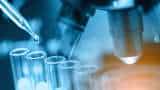 What makes Speciality Chemical sector lucrative, brokerages decode - Alkyl Amines, Tata Chem and UPL may give 11-15% returns What makes Speciality Chemical sector lucrative, brokerages decode - Alkyl Amines, Tata Chem and UPL may give 11-15% returns