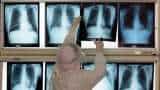 Govt hikes duty on X-ray machine imports to 15% from April 1