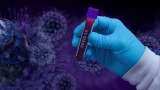 Covid-19 Update: UP reports 4 coronavirus deaths, 462 people tests positive 