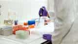 Aurobindo Pharma gets USFDA approval for HIV drug