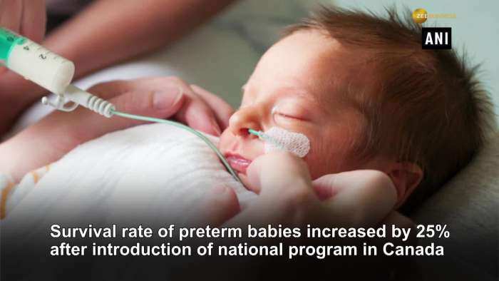 Study reveals survival of premature babies improves by 25% after quality-improvement program