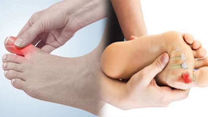 Aapki Khabar Aapka Fayda: Symptoms of foot disease can be fatal!