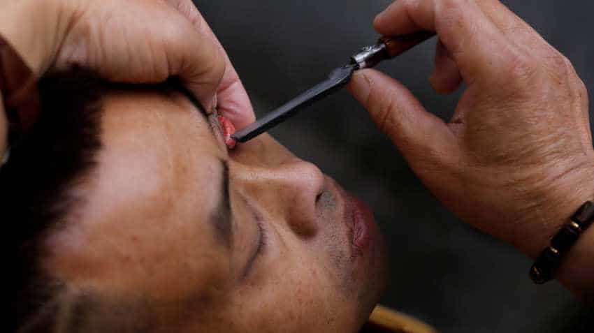 Sun Pharma receives USFDA nod ophthalmic solution used to treat dry eye disease Sun Pharma receives USFDA nod ophthalmic solution used to treat dry eye disease