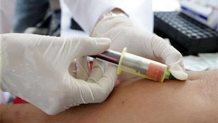 Who is at more risk from Coronavirus? People with this blood type, says study