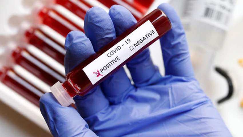 Coronavirus: Whopping Rs 1,125 crore donation committed by this business group Coronavirus: Whopping Rs 1,125 crore donation committed by this business group