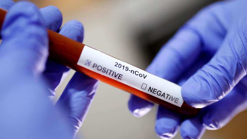 Six-week-old baby dies of coronavirus in US