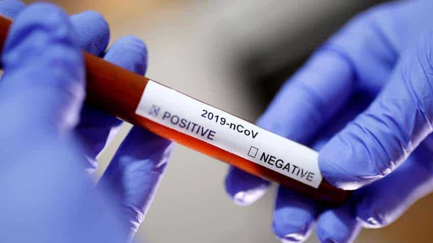 Coronavirus Latest News Update: COVID-19 death toll rises to 824, cases climb to 26,496