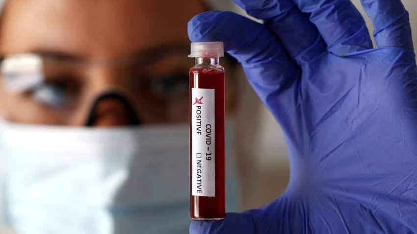 Coronavirus vs Economic Crisis: What's more worrisome? IIM study reveals eye-opening details Coronavirus vs Economic Crisis: What's more worrisome? IIM study reveals eye-opening details