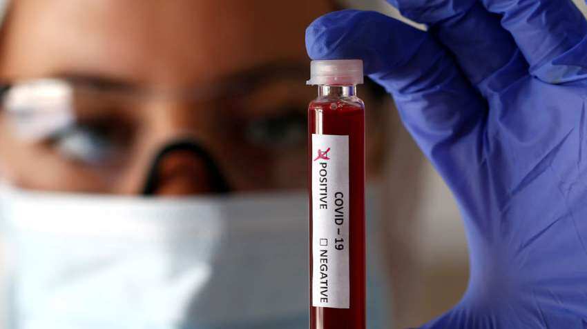 After Bharat Biotech, Zydus COVID-19 vaccine candidate gets nod from Centre for human trials After Bharat Biotech, Zydus COVID-19 vaccine candidate gets nod from Centre for human trials