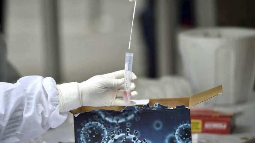 ICMR plans national sero-survey to detect exposure to Covid-19 ICMR plans national sero-survey to detect exposure to Covid-19