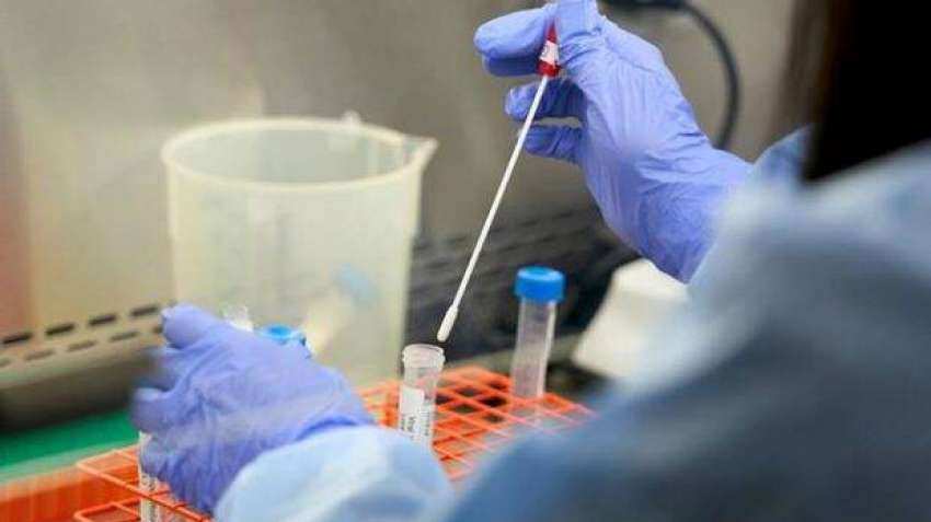 Better than remedesvir and dexamethasone? Novel Covid-19 treatment found by Indian-origin scientists Better than remedesvir and dexamethasone? Novel Covid-19 treatment found by Indian-origin scientists