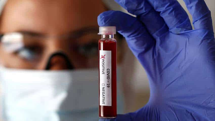 Coronavirus: Highest single-day spike of 64,399 cases; COVID-19 tally zooms past 21 lakh in India