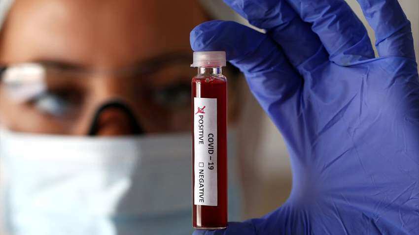 Coronavirus: Highest single-day spike of 64,399 cases; COVID-19 tally zooms past 21 lakh in India Coronavirus: Highest single-day spike of 64,399 cases; COVID-19 tally zooms past 21 lakh in India
