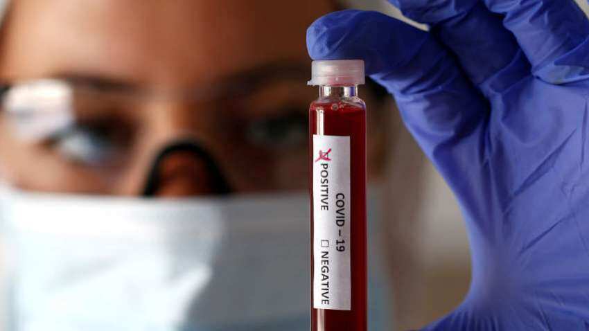 'Investment of Rs 3K-5K cr needed to create extra mfg facilities for COVID-19 vaccine' 'Investment of Rs 3K-5K cr needed to create extra mfg facilities for COVID-19 vaccine'