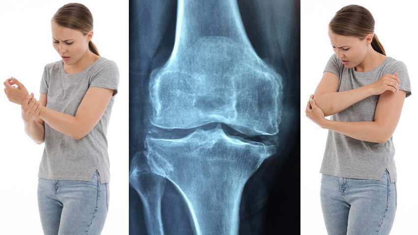Joints pain in winters: Swelling? Stiffness in morning? No energy, appetite? Add this to your diet and see changes Joints pain in winters: Swelling? Stiffness in morning? No energy, appetite? Add this to your diet and see changes