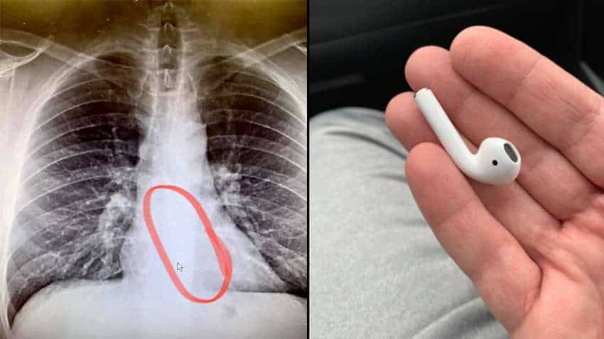 BIZARRE! Man swallows Apple AirPods while sleeping - This is what happened next