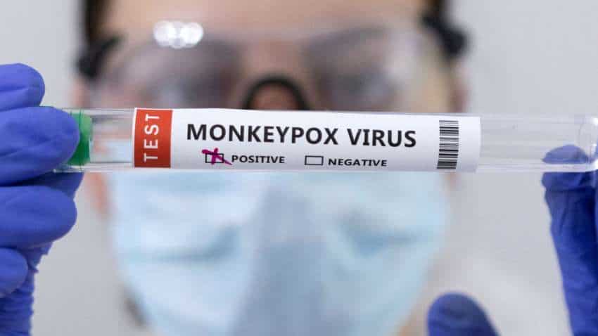 Suspected monkeypox case found in Kerala, samples sent for testing
