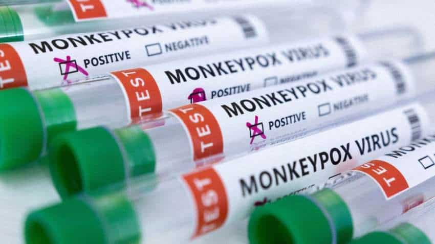 Monkeypox cases in India: Govt orders strict screening of all international travellers