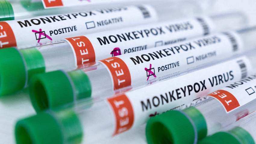WHO issues highest ever alert, declares global health emergency over monkeypox outbreak