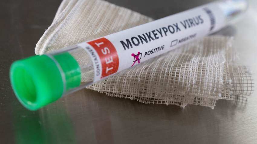 Monkeypox Virus Update: Delhi reports first case of monkeypox , 34-year-old man tests positive Monkeypox Virus Update: Delhi reports first case of monkeypox , 34-year-old man tests positive