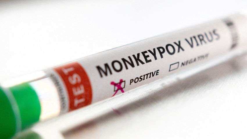 Monkeypox vaccine update: Which country will get it first? World&#039;s biggest vaccine maker SSI&#039;s boss Adar Poonawalla speaks