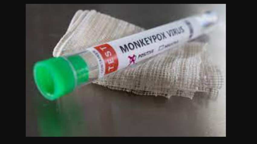  Monkeypox treatment: Antiviral tecovirimat found safe, effective during study
