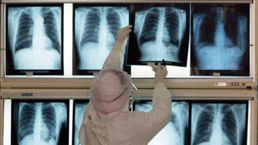 Govt hikes duty on X-ray machine imports to 15% from April 1
