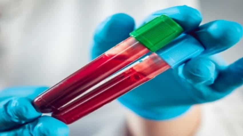 Indian startup develops AI-based blood test to detect 32 cancers early